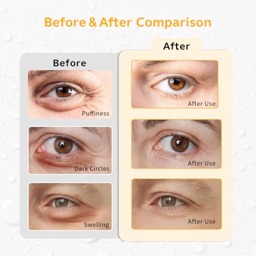4PCS Gel Eye Ice Pack Set Reusable, Cold and Hot Compress for Eyes - color: Oranges-2
