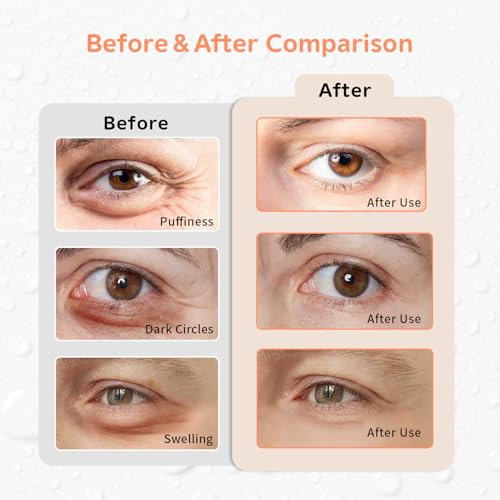 4PCS Gel Eye Ice Pack Set Reusable, Cold and Hot Compress for Eyes - color: Oranges