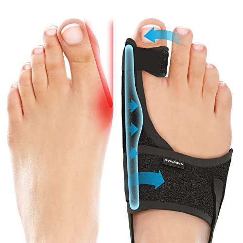 Caretras Bunion Corrector for Women & Men, Hammer Toe Straightener L&R Pair