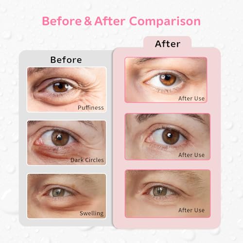 4PCS Gel Eye Ice Pack Set Reusable, Cold and Hot Compress for Eyes - color: Butterflies