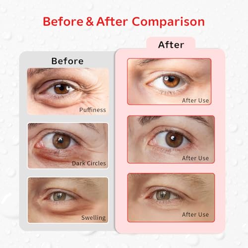 4PCS Gel Eye Ice Pack Set Reusable, Cold and Hot Compress for Eyes - color: Apples
