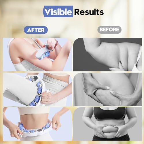 Anti-Cellulite Massage Roller with Handles for Legs & Thighs