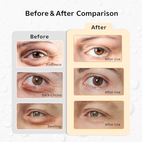 Hot and Cold Eye Pads, Reusable Eye Patches - color: Hedgehogs+red-crowned Cranes