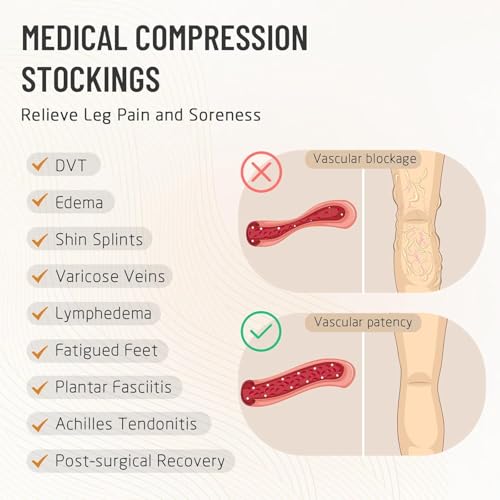 Athbavib 15-20 mmHg Thigh High Compression Socks for Women & Men - color: B-Black(Open Toe), size: Small