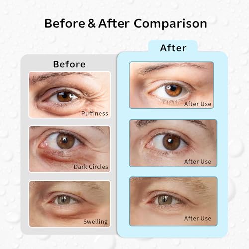 Hot and Cold Eye Pads, Reusable Eye Patches - color: Penguins+owls