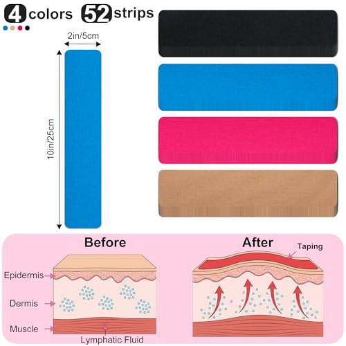52CT Precut Kinesiology Tape Strips-Latex-Free Kinetic Tape for Pain Relief