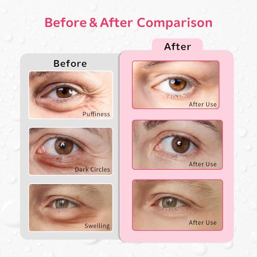 4PCS Gel Eye Ice Pack Set Reusable, Cold and Hot Compress for Eyes - color: Strawberrys