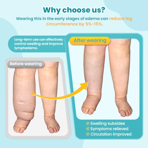 Sylong® Swelling Edema Calf Compression Wrap Adjustable Sleeve For Lower Leg Lymphedema Circulation (2XL) - size: 2XL