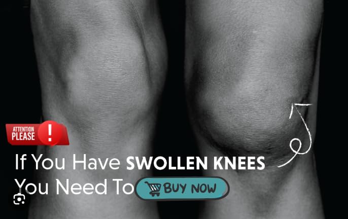 COOLFORCE KNEE BRACE W/O HINGE