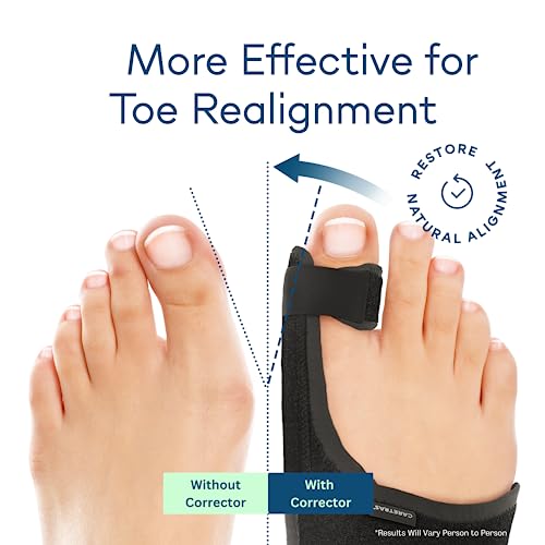 Caretras Bunion Corrector for Women & Men, Hammer Toe Straightener L&R Pair
