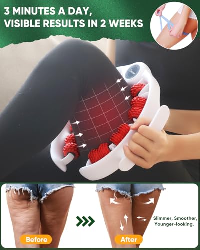 ONUEMP Cellulite Massage Tool Lymphatic Drainage Cellulite Remover for Legs