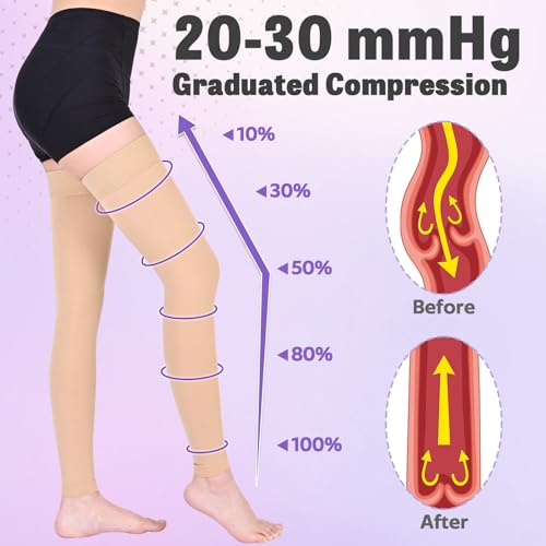 Ktinnead 20-30mmHg Thigh High Compression Socks for Women Men, Footless - color: Beige, size: XX-Large