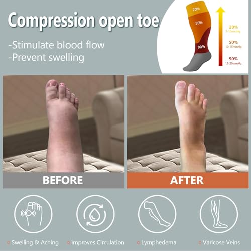 Abodhu Plus Size Compression Socks Open Toe Compression for Women& Men 15-20mmHg Wide Calf Knee High Toeless Compression Sock - color: Baby Pink, size: 3X-Large-4X-Large