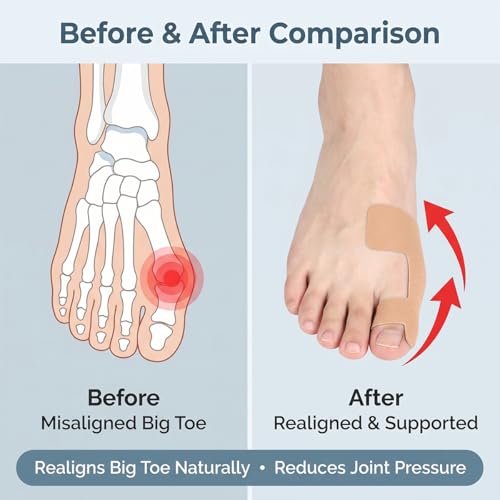 60 PCS Pre-Cut Bunion Corrector Kinesiology Tape– Elastic, Breathable & Hypoallergenic Latex-Free Toe Support Strips, Self-Adhesive Hallux Valgus Corrector for Men & Women