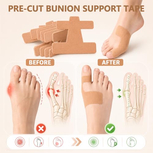 40 Pcs Pre-Cut Bunion Support Tape, Elastic Breathable Latex-Free Kinesiology Tape, Self-Adhesive Hallux Valgus Toe Strips, Skin-Friendly Foot Care Support Strips for Men Women Daily Use (Black) - color: Black