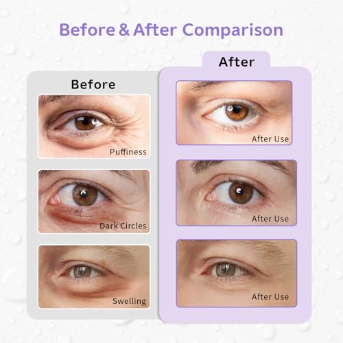 4PCS Gel Eye Ice Pack Set Reusable, Cold and Hot Compress for Eyes - color: Purple Flowers