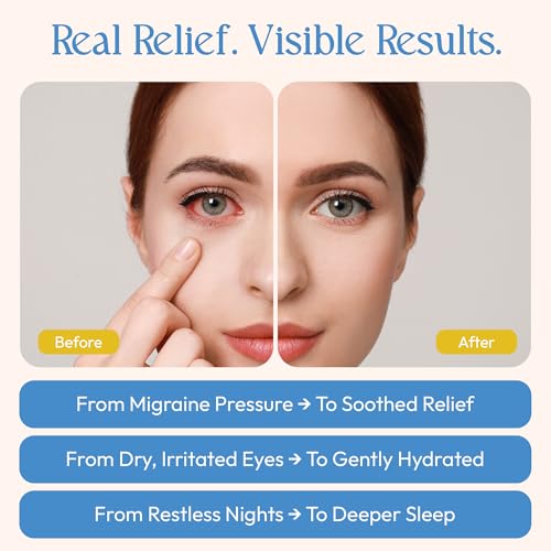 FOMIN Steam Eye Mask (20 Pack) Chamomile Warm Compress - for Dry Eyes - Spa - color: Chamomile