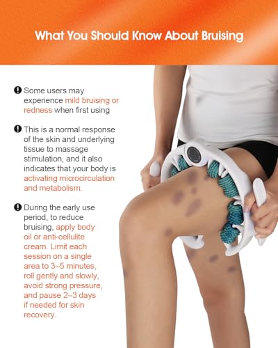Anti Cellulite Massage Tool - Ergonomic Cellulite Remover for Legs and Arms with Detachable Handles - Smooth-Glide Lymphatic Drainage Massager for Boost Confidence and Tightened Skin(Green) - color: Green