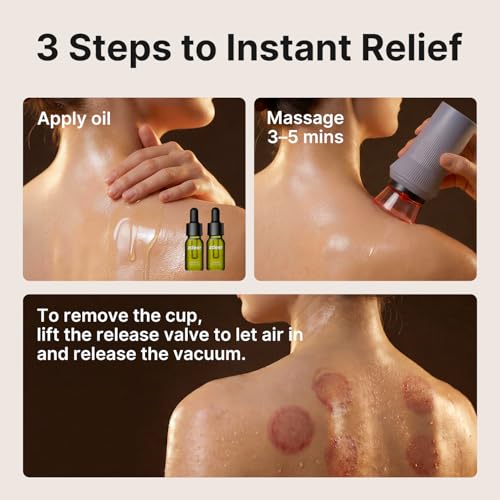 ZDEER Cupping Set, Electric Cupping Kit for Massage Therapy, Lymphatic Drainage Massager with Heat, 6 Levels for Muscle Relaxation, 4 Cups + 2 * 10ml Essential Oil - size: 1 Device + 2 Essential Oils + 4 Cups