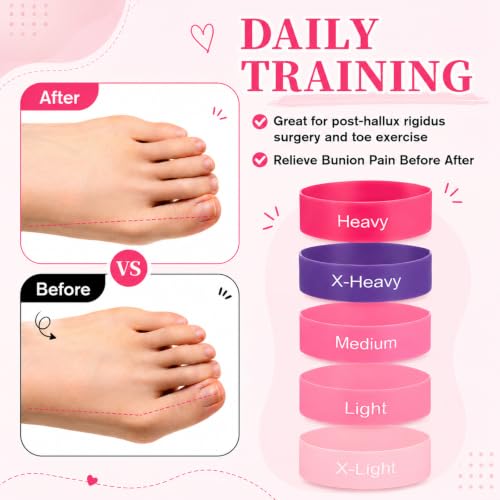 JJUNW 5 Pcs Toe Resistance Bands for Bunions, Toe Stretcher Separator Set - color: Pink