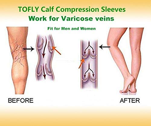 TOFLY Calf Compression Sleeve 20-30mmHg 1 Pair Footless For Men & Women - color: Beige, size: Large (1 Pair)