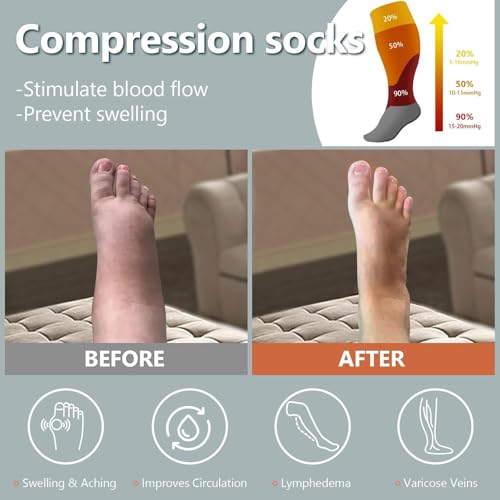 Abodhu Plus Size Compression Socks Open Toe Compression for Women& Men 15-20mmHg Wide Calf Knee High Toeless Compression Sock - color: Rainbow Stripes, size: X-Large-XX-Large
