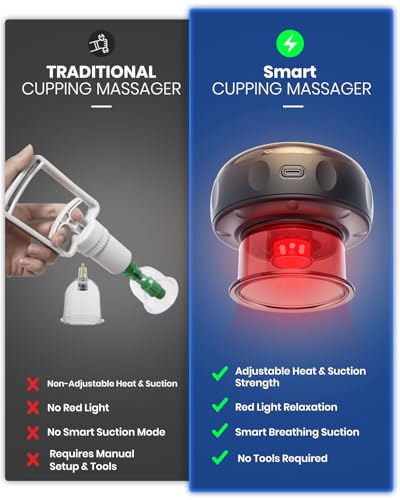 EURPMASK Choose the color of europe 4 Pack Smart Cupping Set with Red Light, Heat & Dynamic Suction, Electric Cupping Therapy Massager with One-Touch Control, Portable Muscle Relaxation Tool - size: 4 Pack