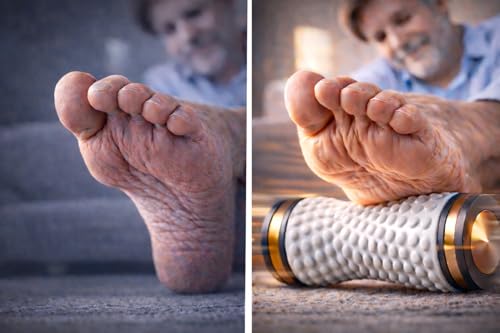 Hulgang Ergonomic Foot Roller for Plantar Fasciitis with Acupressure Deep Tissue Massage