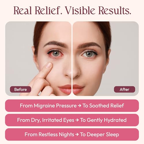 Steam Eye Mask for Fathers Day, 20 Packs Rose & Jasmine Self Heating Warm Compress for Dry Eyes, Puffy Eyes & Dark Circles, Disposable Heated Eye Mask, Travel Essentials & Relaxation Gifts for Men - color: Rose and Jasmine