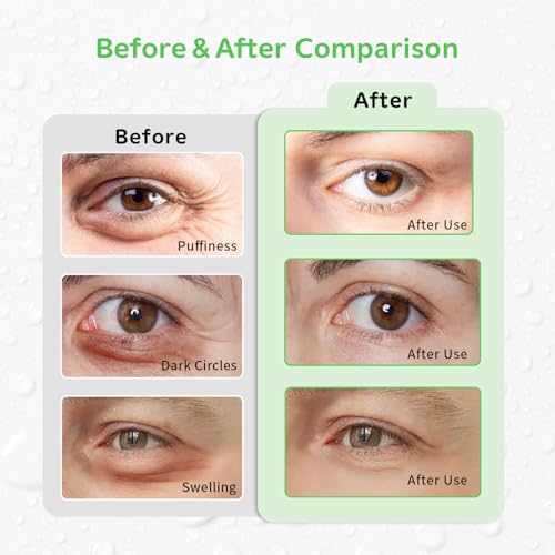 4PCS Gel Eye Ice Pack Set Reusable, Cold and Hot Compress for Eyes - color: Leaves