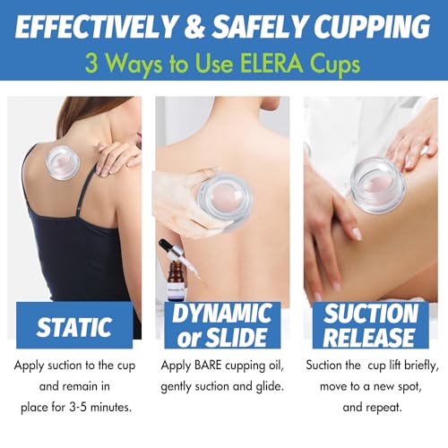 ELERA Silicone Cupping Set for Massage, 4 Cups (XL L M S) - style: 4 Cups (XL L M S size)