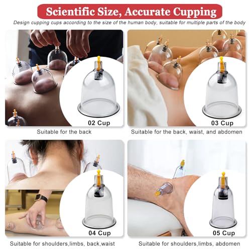 DEFUNX Cupping Set, 19 Cups Cupping Kit for Massage Therapy, Cupping Therapy Set with Pump for Back Massage, Pain Relief, Physical Therapy - size: 19 Cups