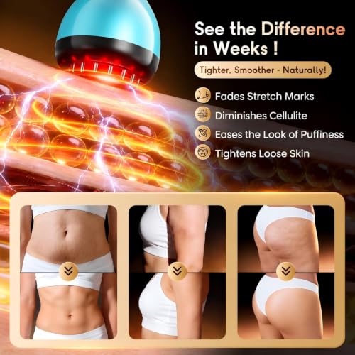 Electric Lymphatic Drainage Massager for Body Anti-Cellulite Sculpting Tool - color: Colorful