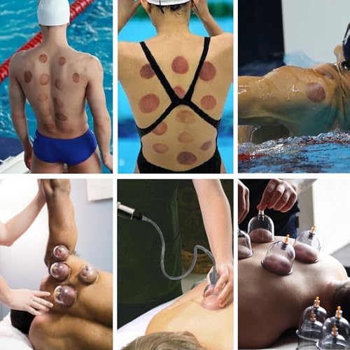 DEFUNX Cupping Set, 12 Cups Cupping Kit for Massage Therapy, Cupping Therapy Set with Pump for Back Massage, Pain Relief, Physical Therapy - size: 12 Cup