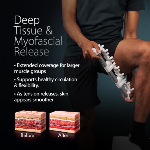 KOA KOAPRO Facia Blaster Tool for Cellulite Area - Muscle Massager Deep Tissue for Full Body, Leg Massager, Muscle Massager for Legs, Fascia Release Tools - style: Full Body Gray