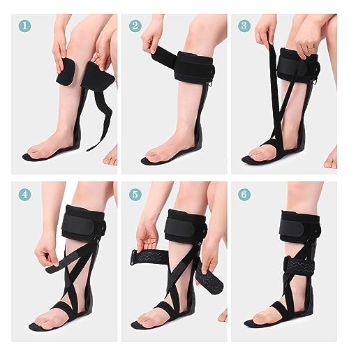 Medical AFO Foot Drop Brace Ankle Foot Orthosis Drop Foot Stabilizer Support for Walking with Shoe for Men and Women for Stroke, MS, Hemiplegia Foot Drop, ALS (XL-Left) - size: XL-Left