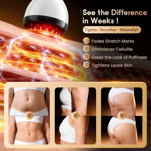 Red Light Lymphatic Drainage Massager Anti Cellulite Massage Tool - color: White