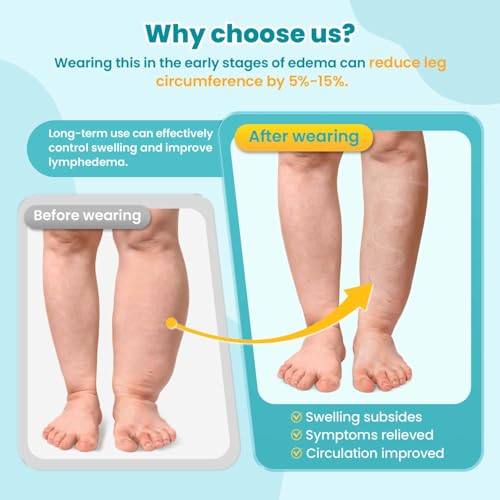 Sylong® Swelling Edema Calf Compression Wrap Adjustable Sleeve For Lower Leg Lymphedema Circulation (M) - size: M