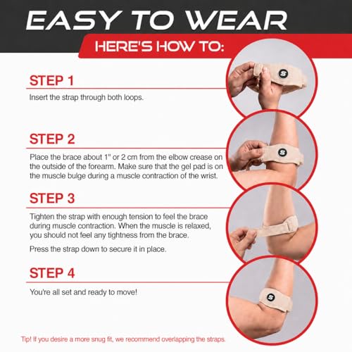 Sleeve Stars Tennis Elbow Brace for Men & Women, Fits 9"-23" (Single/Beige) - color: Beige