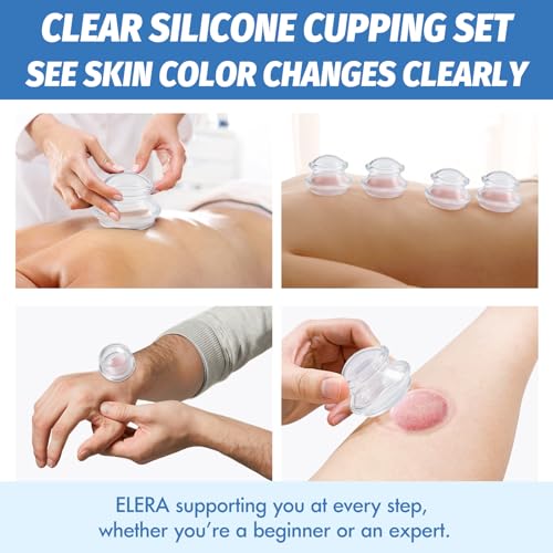ELERA Silicone Cupping Set for Massage, 4 Cups (XL L M S) - style: 4 Cups (XL L M S size)