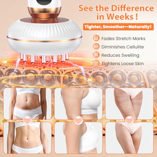 Lymphatic Drainage Massager for Full Body Contouring Smoother-Looking Skin