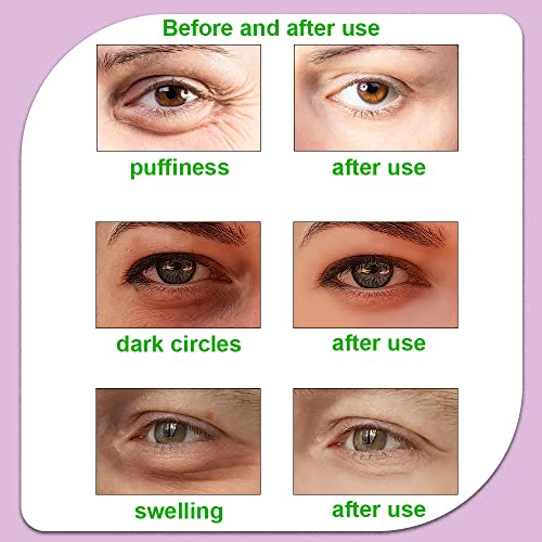 Hot and Cold Eye Pads, Reusable Eye Patches - color: Watermelons+strawberrys