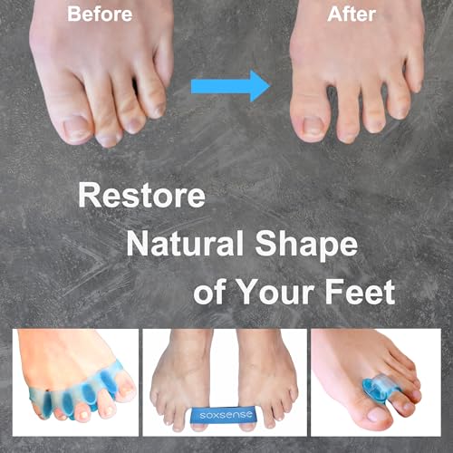 Soxsense 11-Piece Bunion Corrector Kit with Toe Separators & Exercise Bands