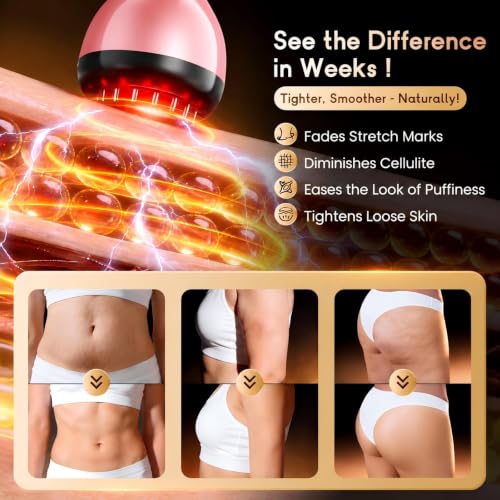 Electric Lymphatic Drainage Massager for Body Anti Cellulite and Thigh - color: Sakura Pink
