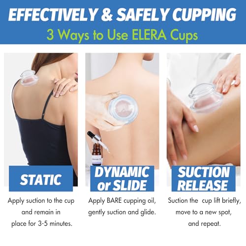 ELERA Silicone Cupping Set for Massage, 7 Cups (2L 2M 3S) - style: 7 Cups (L M S size)