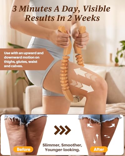 ONUEMP Leg Muscle Roller Lipedema Massagers for Thigh Calve Waist Buttock - size: Leg Roller Massager