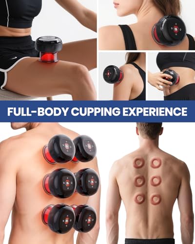 EURPMASK Choose the color of europe 4 Pack Smart Cupping Set with Red Light, Heat & Dynamic Suction, Electric Cupping Therapy Massager with One-Touch Control, Portable Muscle Relaxation Tool - size: 4 Pack