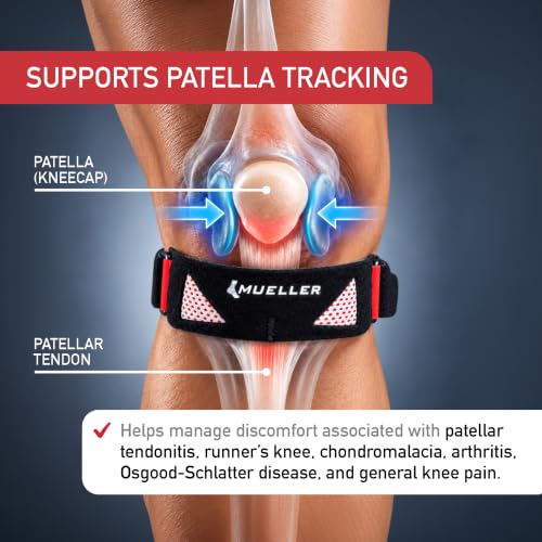 MUELLER Sports Medicine Advanced Patella Strap for Men and Women, Knee Compression and Pain Relief Support, Ideal for Osgood-Schlatter's, Runner's Knee, Patellar Tendinitis, Black, One Size