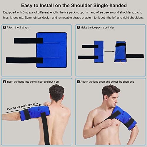 Koo-Care Extra Large Gel Ice Pack for Injuries Reusable Flexible Hot Cold Compress with Wrap for Shoulder Rotator Cuff, Back, Hip, Shin, Knee Replacement Surgery Pain Relief 13.1" x 14.7" XL Pack of 2 - size: 13.1 x 14.7 Inch (Pack of 2)