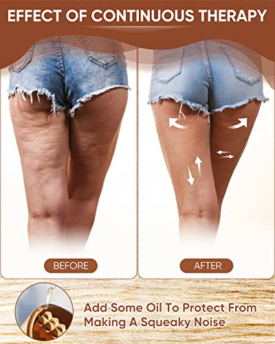ONUEMP Wooden Lymphatic Drainage Body Sculpt Cup with Guasha Fascia Roller - size: Cup